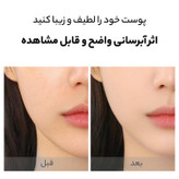 ماسک صورت بایو آکوا مدل ویتامین سی حجم 25 میلیلیتر، آبرسان، روشنکننده، ضد چروک، کوچککننده منافذ پوست، مناسب پوست چرب